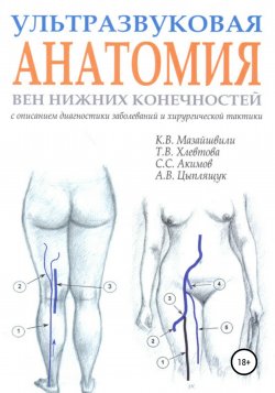 Ультразвуковая анатомия вен нижних конечностей - Константин Мазайшвили